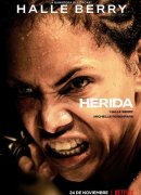 Herida